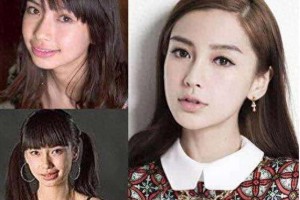 明星整牙前后对比：Angelababy、高圆圆等颜值逆袭
